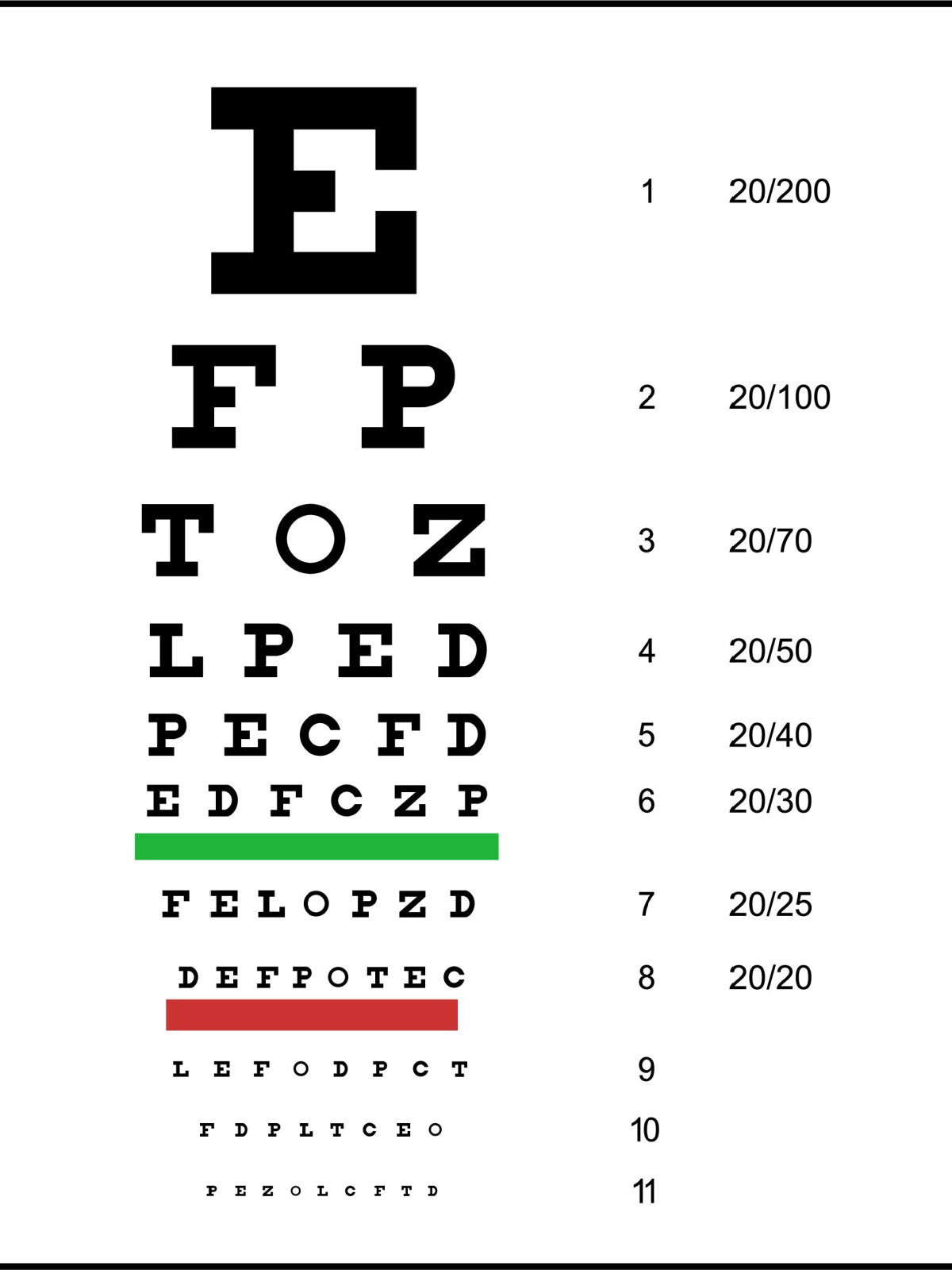 Krátkozrakosť test